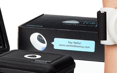 Control Bionics set to enter the ASX bourse next week; inspired by Stephen Hawking and already FDA approved